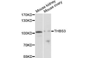 Western blot analysis of extracts of various cell lines, using THBS3 antibody (ABIN1875090) at 1:1000 dilution. (THBS3 抗体)