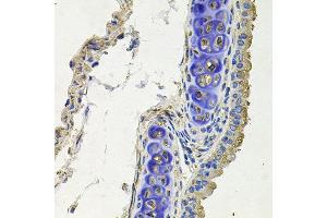 Immunohistochemistry of paraffin-embedded mouse lung using SKP1 antibody at dilution of 1:100 (x40 lens). (SKP1 抗体)