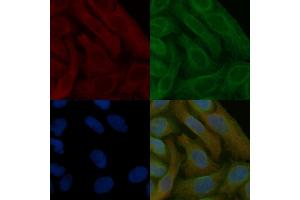Peroxiredoxin 5 Mouse Monoclonal Antibody staining Hela cells by IF/ICC. (Peroxiredoxin 5 抗体  (C-Term))
