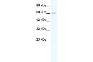 WB Suggested Anti-ZNF79 Antibody   Titration: 0. (ZNF79 抗体  (N-Term))