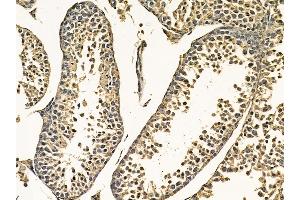 Integrin beta3 Mouse Monoclonal Antibody at 1/100 staining mouse testis tissue by IHC-P.