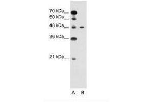 Image no. 1 for anti-Pre-B-Cell Leukemia Homeobox Protein 1 (PBX1) (N-Term) antibody (ABIN6736594) (PBX1 抗体  (N-Term))