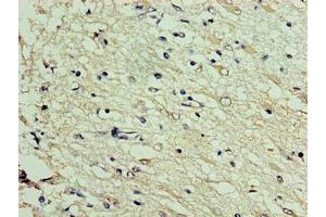 Immunohistochemistry of paraffin-embedded human brain tissue using ABIN7150554 at dilution of 1:100 (DNAJC3 抗体  (AA 1-226))