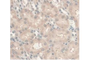 Detection of AR in Rat Kidney Tissue using Monoclonal Antibody to Androgen Receptor (AR) (Androgen Receptor 抗体  (AA 491-679))