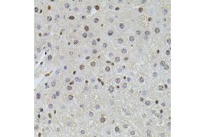 Immunohistochemistry of paraffin-embedded mouse liver using PLK4 antibody (ABIN6003595) at dilution of 1/100 (40x lens). (PLK4 抗体)