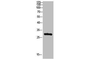 Western Blot analysis of hepg2 cells using Antibody diluted at 500. (MYOZ2 抗体  (AA 21-70))