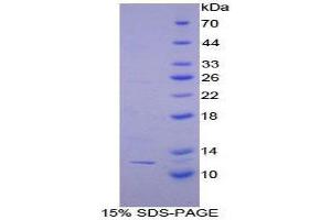 SDS-PAGE (SDS) image for Peptide YY (PYY) (AA 30-98) protein (His tag) (ABIN1879947) (Peptide YY Protein (PYY) (AA 30-98) (His tag))