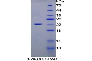 SDS-PAGE analysis of Rat Interferon alpha Protein. (IFNA 蛋白)