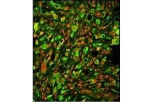 Immunofluorescence (IF) image for anti-Protein tyrosine Phosphatase Type IVA, Member 2 (PTP4A2) (AA 32-59) antibody (ABIN390820)