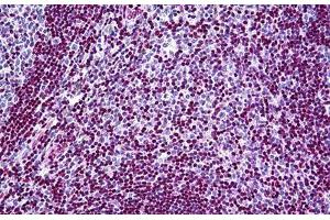 Human Tonsil: Formalin-Fixed, Paraffin-Embedded (FFPE) (MECP2 抗体  (AA 81-170))