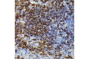 Immunohistochemistry (IHC) image for anti-Apolipoprotein C-III (APOC3) (AA 1-99) antibody (ABIN7265641)