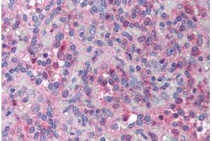 Human Spleen (formalin-fixed, paraffin-embedded) stained with XAF1 antibody ABIN214019 at 10 ug/ml followed by biotinylated goat anti-rabbit IgG secondary antibody ABIN481713, alkaline phosphatase-streptavidin and chromogen. (XAF1 抗体)