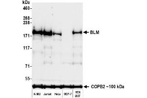 Western Blotting (WB) image for anti-Bloom Syndrome RecQ Like Helicase (BLM) (C-Term) antibody (ABIN7795725) (Recombinant BLM 抗体  (C-Term))