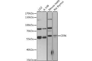Western blot analysis of extracts of various cell lines, using CERK antibody (ABIN7266282) at 1:1000 dilution. (CERK 抗体  (C-Term))