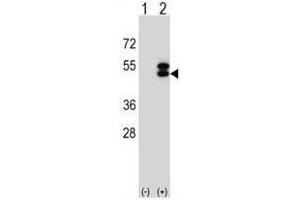 Western Blotting (WB) image for anti-Ataxin 3 (ATXN3) (AA 267-297), (Middle Region) antibody (ABIN950546)