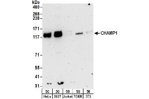 anti-Zinc Finger Protein 828 (ZNF828) (AA 1-50) antibody
