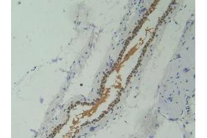 IHC-P analysis of Mouse Skeletal muscle Tissue, with DAB staining.