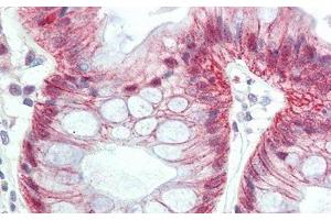Detection of MTF1 in Human Colon Tissue using Polyclonal Antibody to Metal Regulatory Transcription Factor 1 (MTF1) (MTF1 抗体  (AA 2-139))