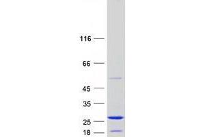 Western Blotting (WB) image for Zinc Finger, Matrin-Type 5 (ZMAT5) (Transcript Variant 1) protein (Myc-DYKDDDDK Tag) (ABIN2735913)