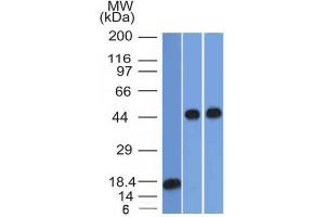 Western Blot Analysis of 1) recombinant Alpha-1-Antitrypsin 2) Jurkat & 3) A549 cell lysate using Alpha-1-Antitrypsin Mouse Monoclonal Antibody (AAT/1378). (SERPINA1 抗体)