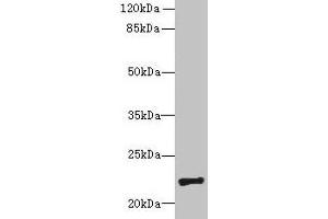 Western blot All lanes: PIGH antibody at 4 μg/mL + Mouse kidney tissue Secondary Goat polyclonal to rabbit IgG at 1/10000 dilution Predicted band size: 22 kDa Observed band size: 22 kDa (PIGH 抗体  (AA 1-188))