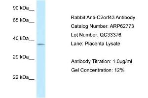 Western Blotting (WB) image for anti-Lipid Droplet-Associated Hydrolase (LDAH) (C-Term) antibody (ABIN2789241) (LDAH/C2orf43 抗体  (C-Term))