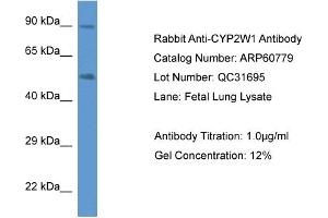 Western Blotting (WB) image for anti-Cytochrome P450, Family 2, Subfamily W, Polypeptide 1 (CYP2W1) (C-Term) antibody (ABIN786271) (CYP2W1 抗体  (C-Term))