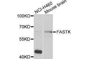Western blot analysis of extracts of various cell lines, using FASTK antibody (ABIN5974251) at 1/1000 dilution. (FASTK 抗体)