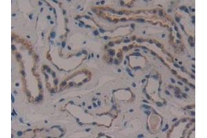 Immunohistochemistry (IHC) image for anti-Citrate Synthase (CS) (AA 103-394) antibody (ABIN7440647)