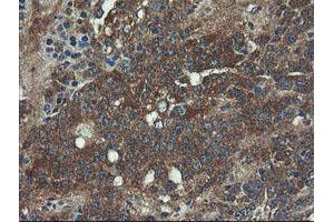 Image no. 11 for anti-Prefoldin Subunit 3 (PFDN3) antibody (ABIN1501704)