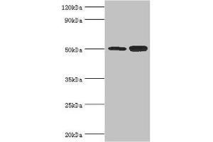 Western blot All lanes: Polycomb protein EED antibody at 4 μg/mL Lane 1: Hela whole cell lysate Lane 2: K562 whole cell lysate Secondary Goat polyclonal to rabbit IgG at 1/10000 dilution Predicted band size: 51, 54, 46 kDa Observed band size: 51 kDa (EED 抗体  (AA 1-300))