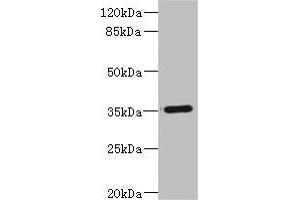 Western blot All lanes: FCGR2C antibody IgG at 1. (FCGR2C 抗体  (AA 43-223))
