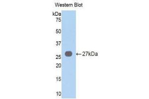 Western Blotting (WB) image for anti-Vav 3 Oncogene (VAV3) (AA 183-380) antibody (ABIN1860913) (VAV3 抗体  (AA 183-380))