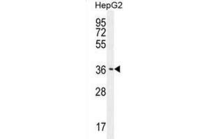 Western Blotting (WB) image for anti-CCR4-NOT Transcription Complex, Subunit 8 (CNOT8) antibody (ABIN2996023) (CNOT8 抗体)