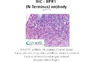 Image no. 1 for anti-Xenotropic and Polytropic Retrovirus Receptor 1 (xpr1) antibody (ABIN1740878)