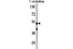 Western Blotting (WB) image for anti-Cyclin-Dependent Kinase 14 (CDK14) antibody (ABIN3002794) (CDK14 抗体)