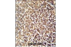 ZNF98 antibody (C-term) (ABIN654480 and ABIN2844215) immunohistochemistry analysis in formalin fixed and paraffin embedded human lymphnode followed by peroxidase conjugation of the secondary antibody and DAB staining.