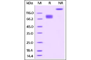 SDS-PAGE (SDS) image for CD86 (CD86) (AA 26-247) (Active) protein (Fc Tag,AVI tag,Biotin) (ABIN3137664)