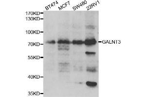 Western blot analysis of extracts of various cell lines, using GALNT3 antibody. (GALNT3 抗体  (AA 1-140))