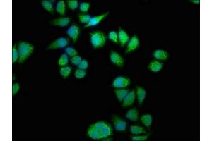 Immunofluorescence staining of Hela cells with ABIN7168857 at 1:133, counter-stained with DAPI. (Septin 11 抗体  (AA 237-429))