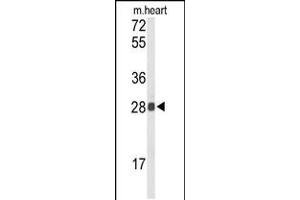 Western blot analysis of TSPAN1 Antibody in mouse heart tissue lysates (35ug/lane) (TSPAN1 抗体  (AA 140-167))