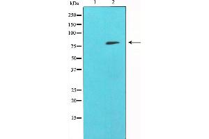 Western blot analysis of SYK expression in whole cell lysates,The lane on the left is treated with the antigen-specific peptide. (SYK 抗体)