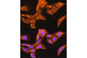 Immunofluorescence analysis of L929 cells using CDV3 Rabbit pAb (ABIN7266240) at dilution of 1:100. (CDV3 抗体)