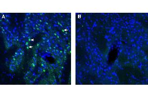 Expression of ADAM23 in rat striatum. (Adam23 抗体  (Extracellular))