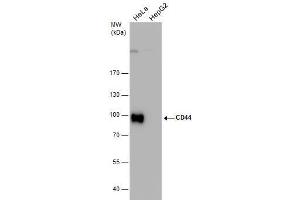 WB Image CD44 antibody detects CD44 protein by western blot analysis. (CD44 抗体)