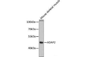 Western blot analysis of extracts of Mouse skeletal muscle using ADAP2 Polyclonal Antibody at dilution of 1:3000.