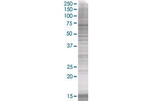 CEACAM5 transfected lysate. (CEACAM5 293T Cell Transient Overexpression Lysate(Denatured))