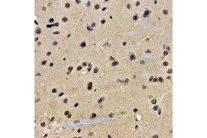 Immunohistochemical analysis of ATIC staining in rat brain formalin fixed paraffin embedded tissue section. (ATIC 抗体)