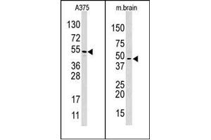 Image no. 1 for anti-Hypoxia Inducible Factor 1, alpha Subunit Inhibitor (HIF1AN) (C-Term) antibody (ABIN356560) (HIF1AN 抗体  (C-Term))