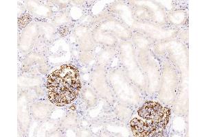 Immunohistochemistry analysis of paraffin-embedded human kidney using NES Monoclonal Antibody at dilution of 1:400. (Nestin 抗体)